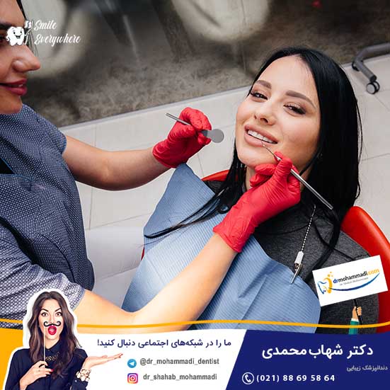 پولیش دندان بعد از کامپوزیت - کلینیک دندانپزشکی دکتر شهاب محمدی